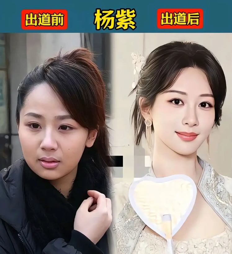 没有当明星之前，很多人不在乎自己的公众形象，不在乎以素颜示人，但成为了大明星之后