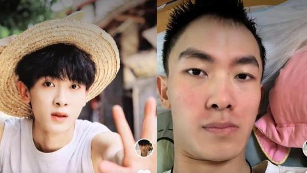 27岁男偶像周墨，惯性熬夜，脑中风