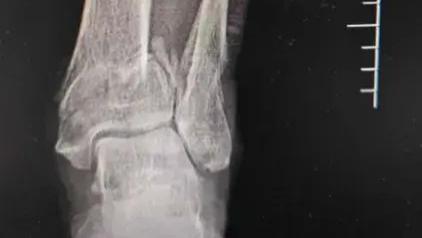 南天实录第185期：耍花招玩心眼？看看专家答应不答应