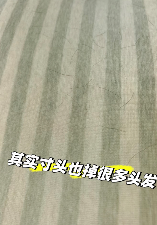 原来寸头也会掉很多头发，长发短发都逃不过掉发的烦恼呀 ​

