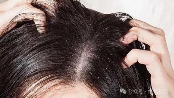 头发干枯像稻草？早餐别只喝牛奶配面包，加勺厨房都有的它，助你养出柔顺光泽