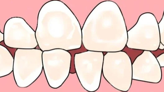 你的牙齿有没有这种白斑？可能是牙齿在“求救”！快看看你是哪种情况