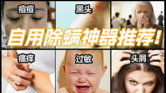 家庭用除螨仪有必要没有？家庭除螨虫最好的办法最有效的方法？除螨仪品牌十大排名推荐：盘点实测好用款