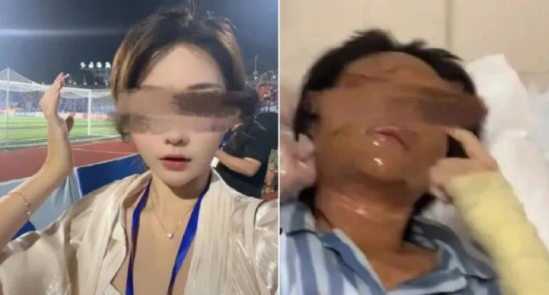 湖南永州女主播思思（化名）被炸伤案有了新进展。6月7日，思思告诉 记者，案件一审