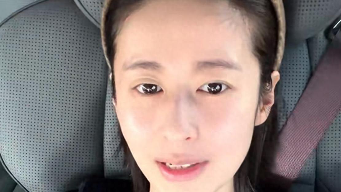 颖儿在视频末尾还晒出了做项目前后对比照