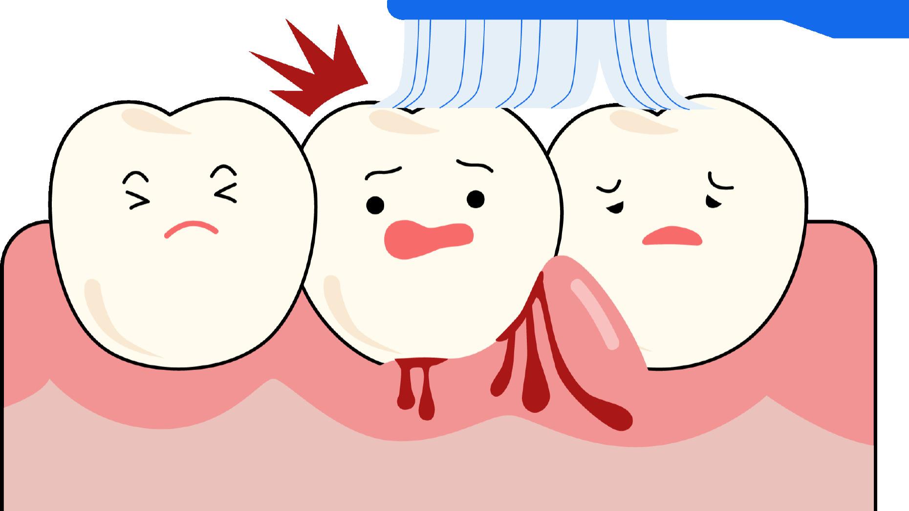 牙龈肿痛、口腔溃疡、嘴角起泡……年后口腔“上火”怎么办？