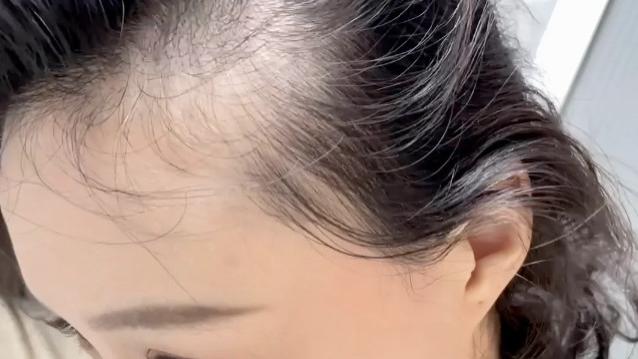 什么洗发露防脱发生发效果好