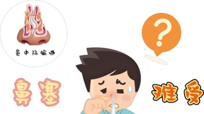 反复鼻塞、头痛、打鼾？别只怪鼻炎，查查鼻中隔