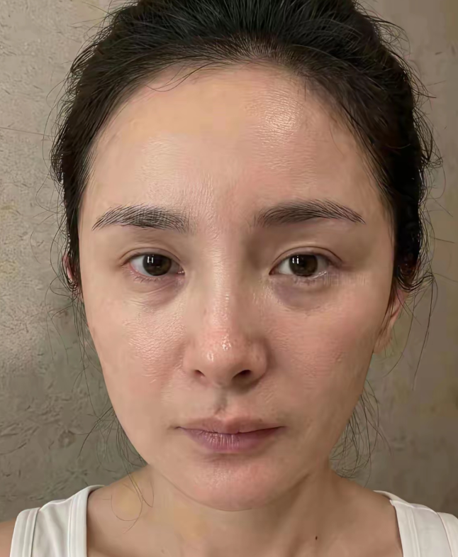 杨幂的黑眼圈很重毛孔粗大
细纹不是很明显，没有鱼尾纹，总体还是保养的不错，要说多