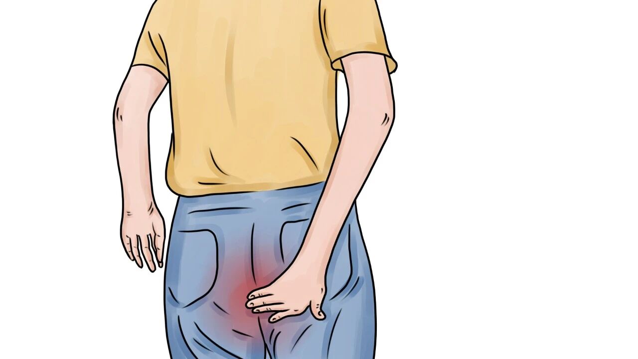 撑大的肛门还能恢复吗？医生：不用过于慌张，做好这3点就够了