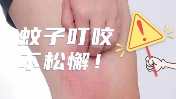 房间灭蚊灯哪个牌子好用？十大旗舰房间灭蚊灯品牌推荐！希亦/美的等十款实力在线的灭蚊灯品牌盘点