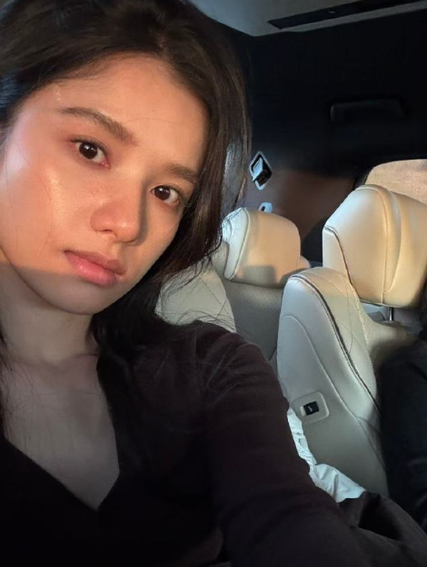 张婧仪昨日发布最新动态，看到脸上起小疹子了好心疼仪宝啊，还说“各种状态都可以被看
