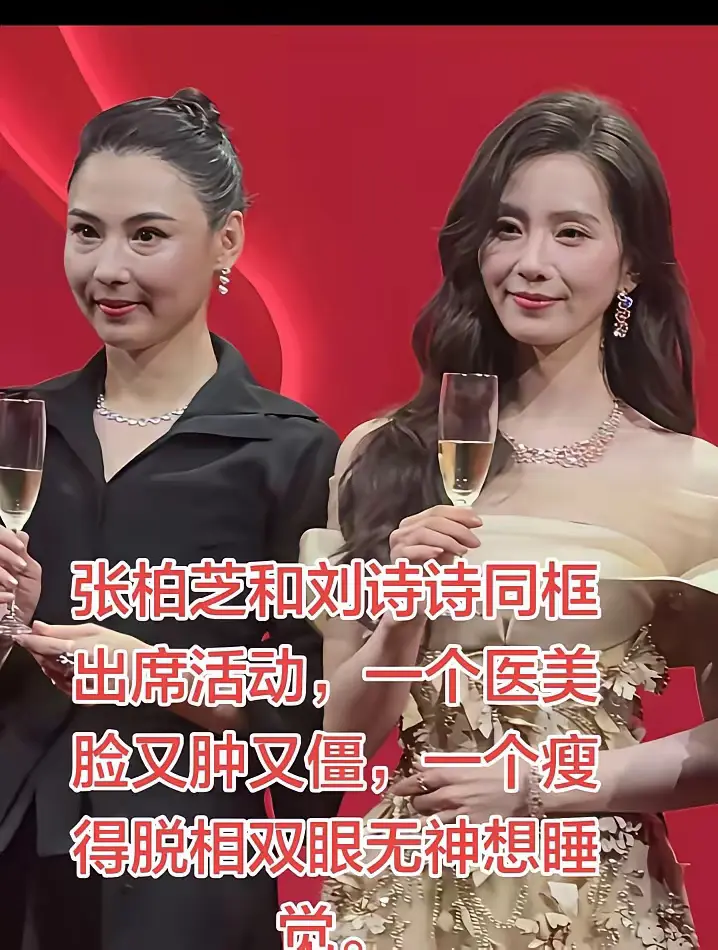 天呐，张柏芝的脸怎么了？