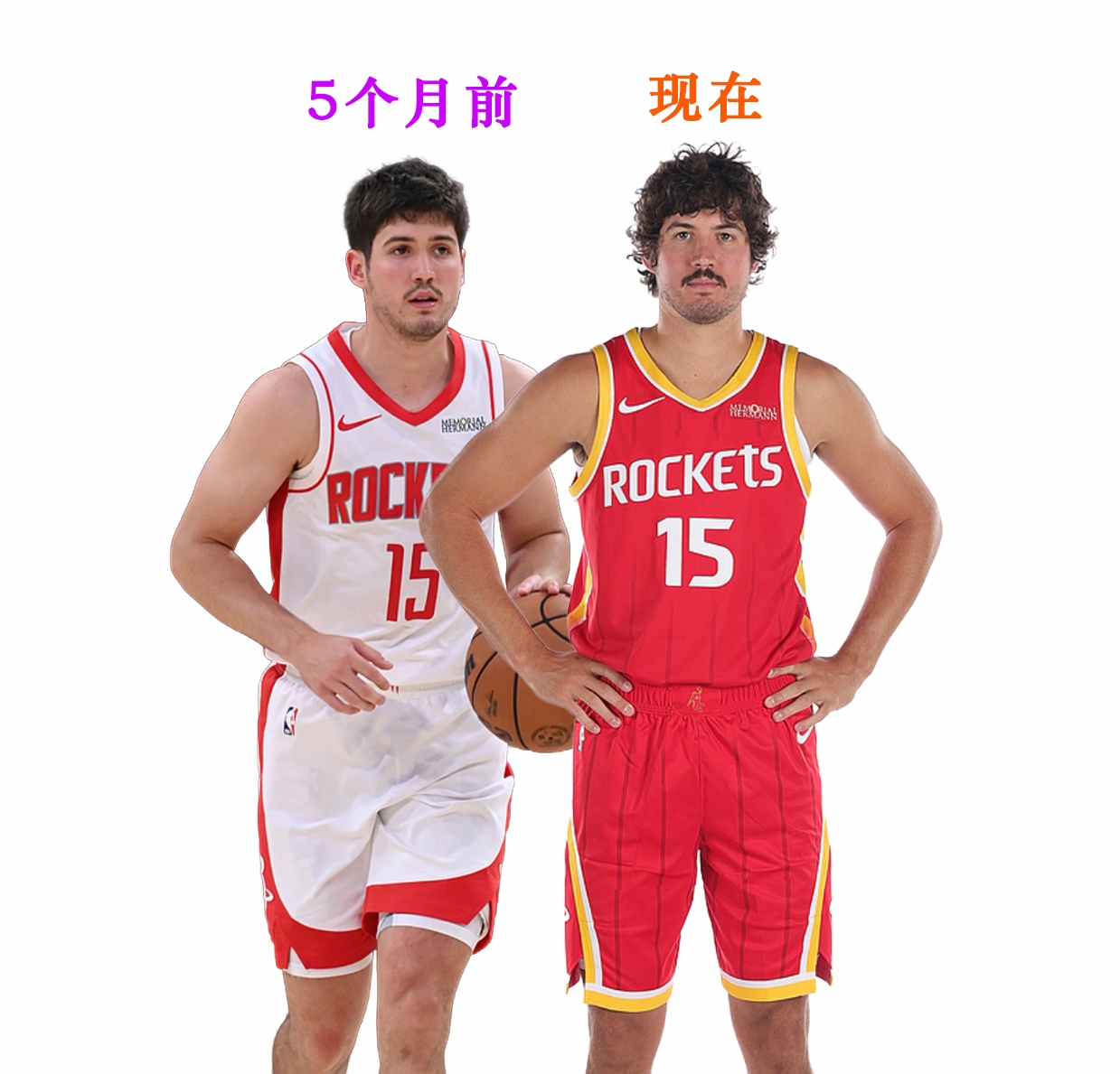 北京时间2026年9月23日，火箭媒体日，火箭后卫谢泼德的亮相让大家吃了一惊，他