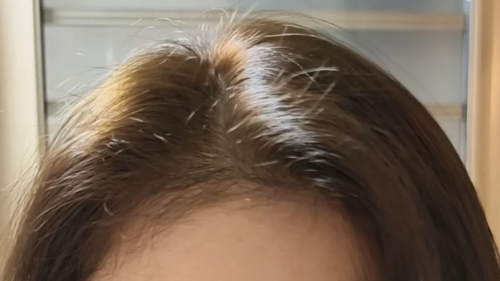 断发修护头皮精华哪个牌子好用？儒曼防断健发头皮精华液，梳头断发用哪款修护效果好