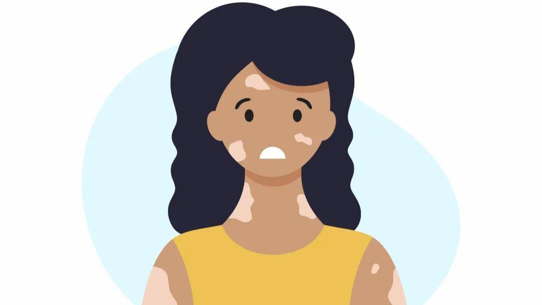 身上突然长白斑？别再忽视这些“隐形导火索”！