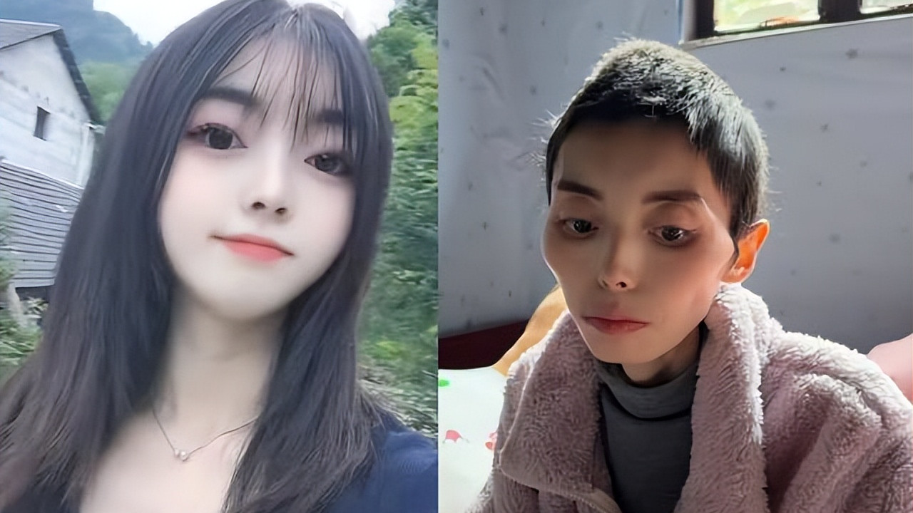 贵州美女周艳去世！年仅31岁，死因曝光，最后体重只剩30斤