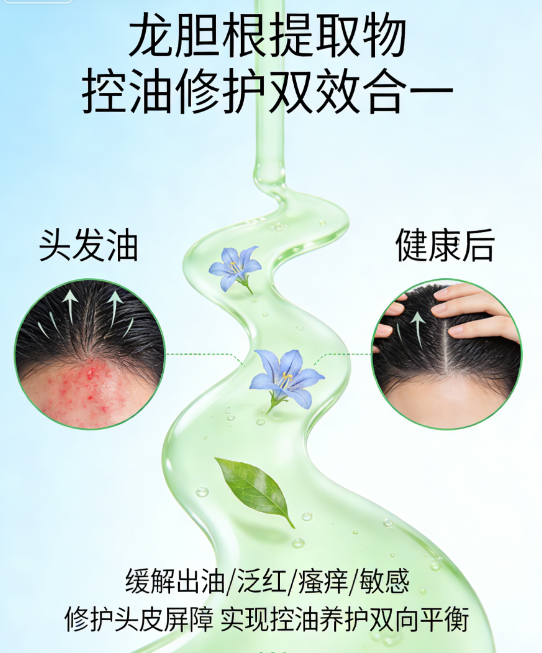 油性头皮护理新方案：科学应对油脂堵塞困扰