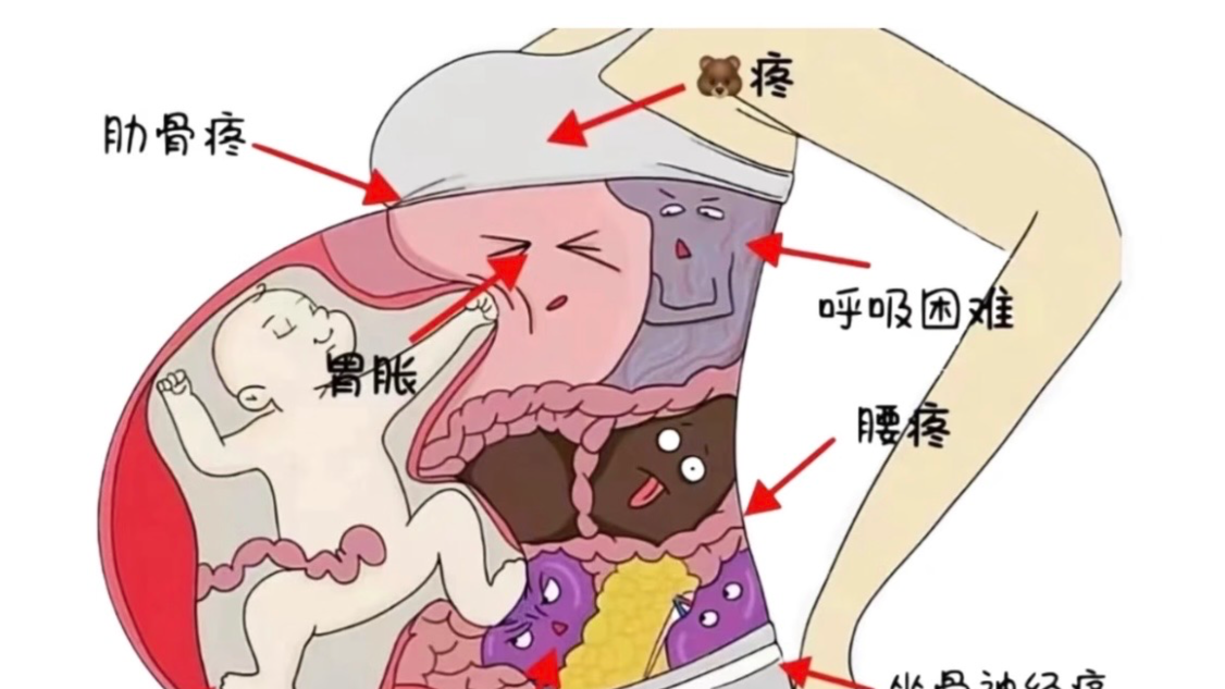 正视女性生育损伤