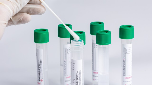 生殖器疱疹病毒如何彻底清除？这4步可以实现临床治愈！