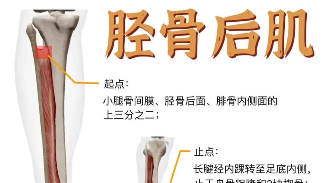 胫骨后肌失能：足踝酸胀疼痛的 “隐形元凶”