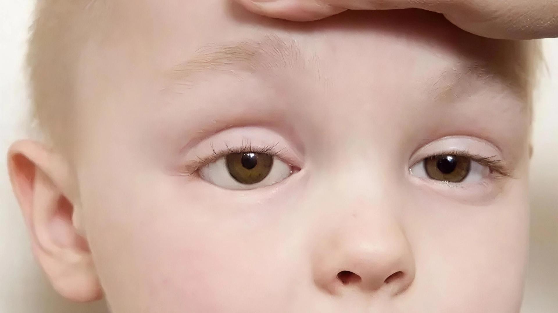 宝宝眼睛进睫毛，别揉！科学应对指南