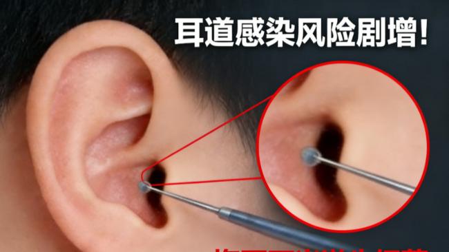 掏耳勺买什么样的好？掏耳神器哪种最好用？可视挖耳勺推荐