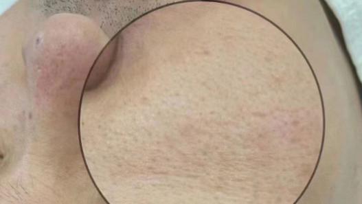 皮肤：人类进化与中医智慧