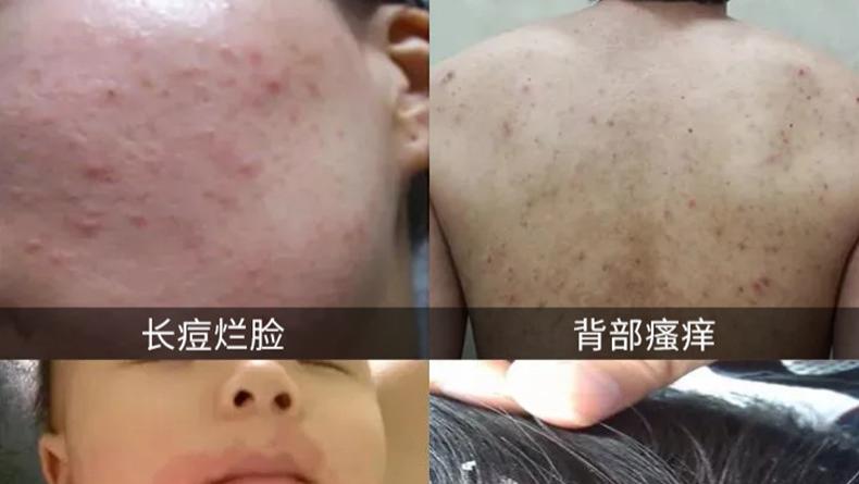 除螨仪家用床上杀菌机第一名？床上除螨仪是不是智商税？2026年家用除螨仪推荐排名前十名，必看系列！