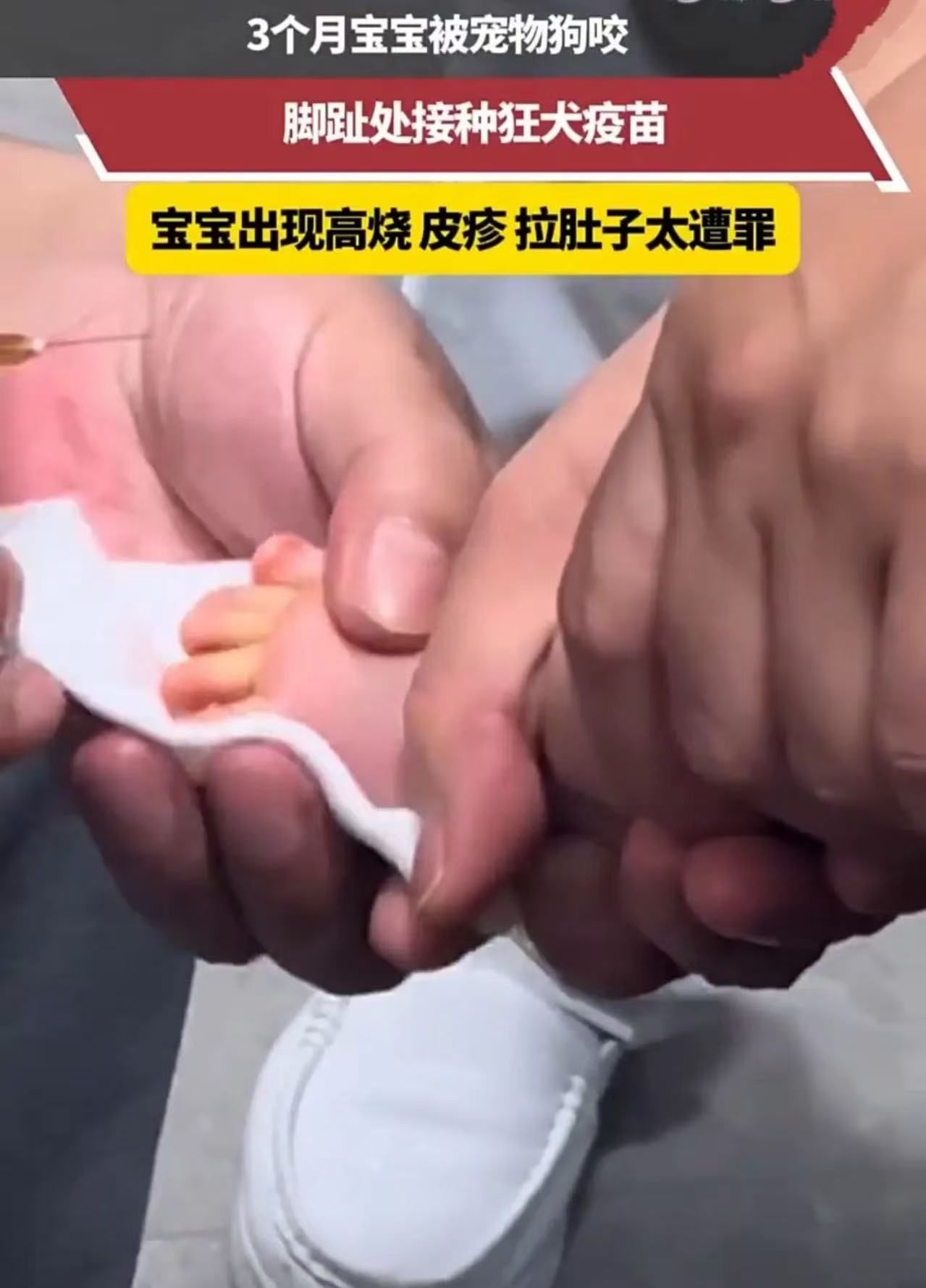 “这次养狗的后悔了！”就因为家里养的狗“吃醋”，才三个月大的宝宝，硬生生遭了半条