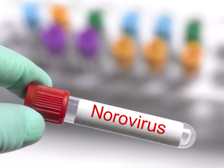 可怕！日本多地发生食物中毒事件