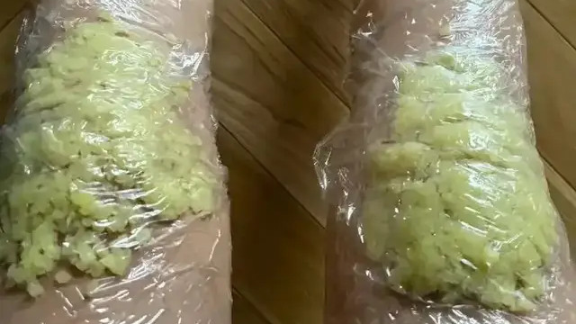 网上爆火的“生姜敷腿治静脉曲张”，真的靠谱吗？