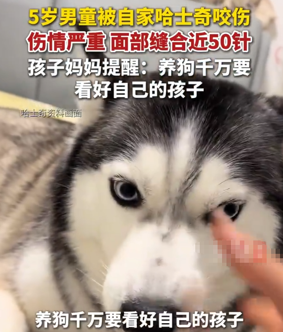 5月1日（采访），江苏徐州，一名5岁男童被自家饲养多年的哈士奇咬伤，面部、颈部等