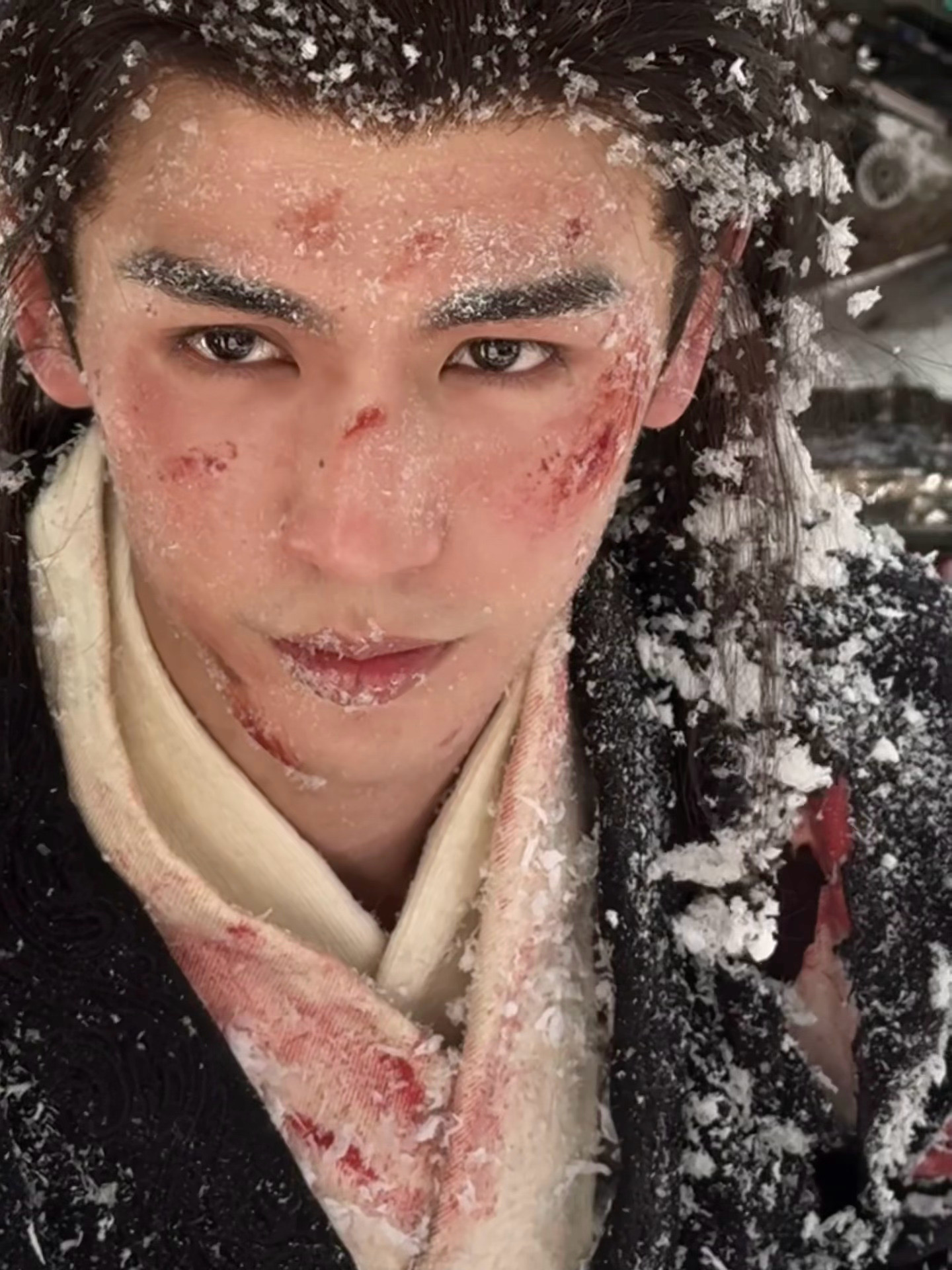 跨年靠走路圈粉无数的张凌赫，受伤的时候也让人怜惜呢。张凌赫晒出自己戏中受伤剧照，