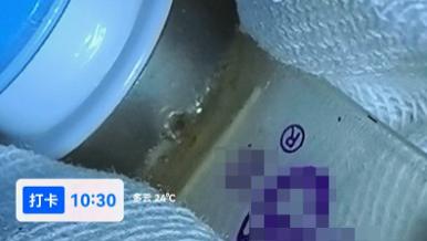 贵州一名 65 岁患者拔管操作流程存争议，病情危重难以脱离呼吸机