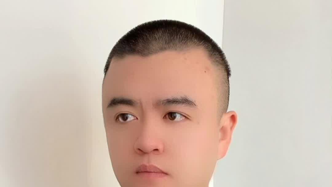 一个小孩眼珠中间是白色的四周都是黑色的！