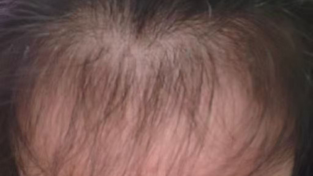 一场关于时间与耐心的自我疗愈