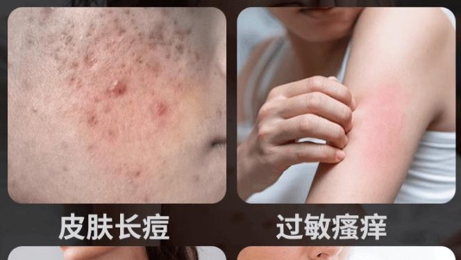 床上除螨仪是智商税吗？家用除螨仪哪个牌子效果好？精选热门除螨仪排行榜10强品牌，抢先看！