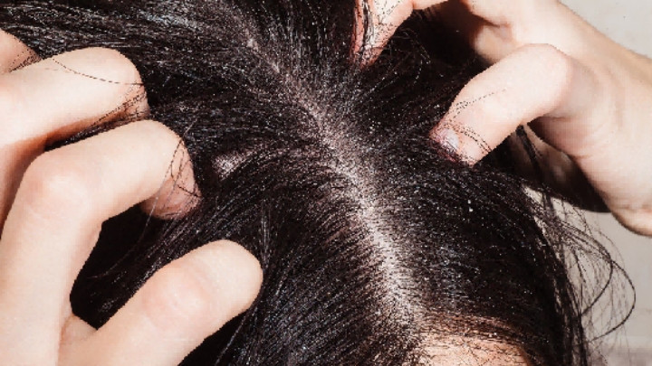 敏感头皮实测！摩洛哥护发精油好用吗？拾宓vs摩洛哥！