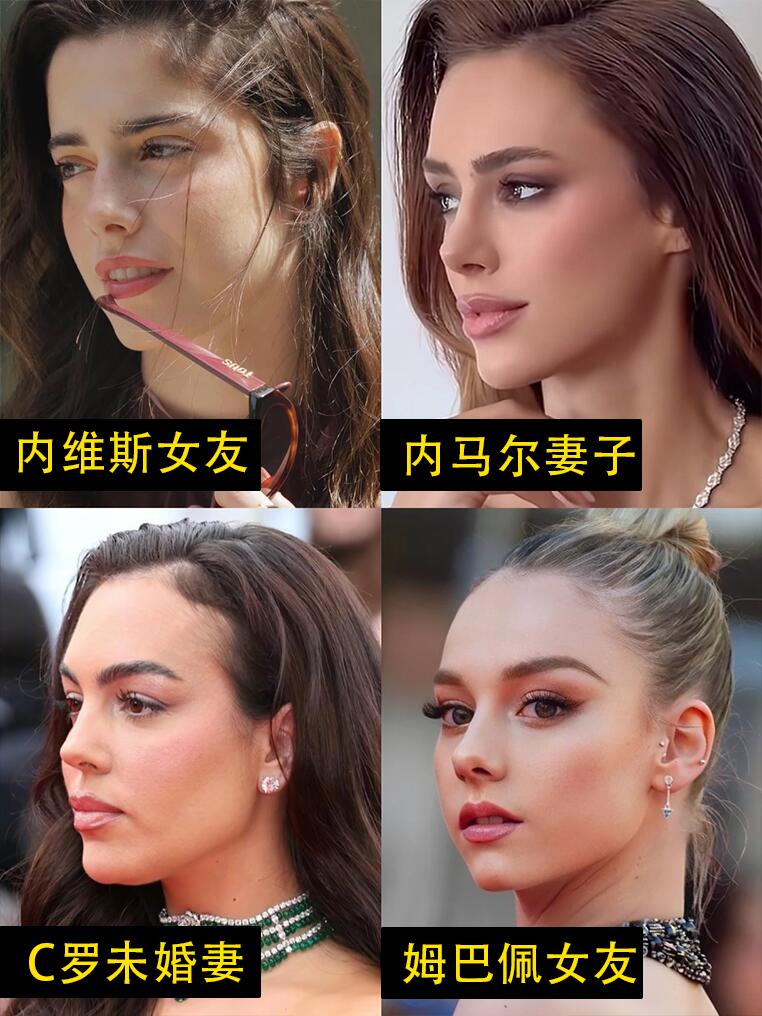 内维斯女友发际线额角绒毛丰富，显得青春清爽
	
内马尔妻子的发际线就很完整，几乎