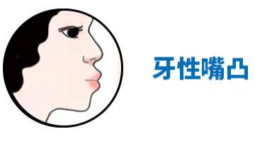 嘴凸怎么改善？先分清你是牙性、骨性还是功能性
