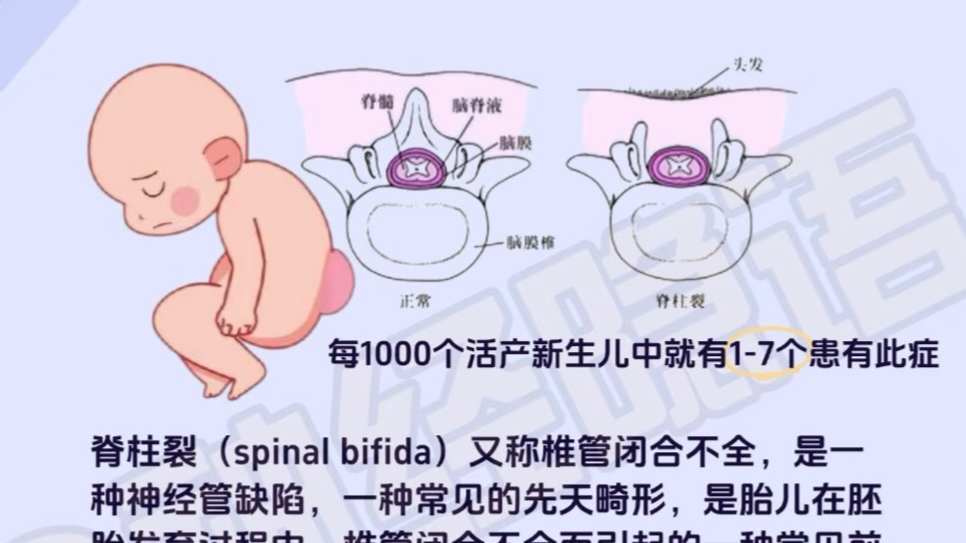 孕期细节要注意