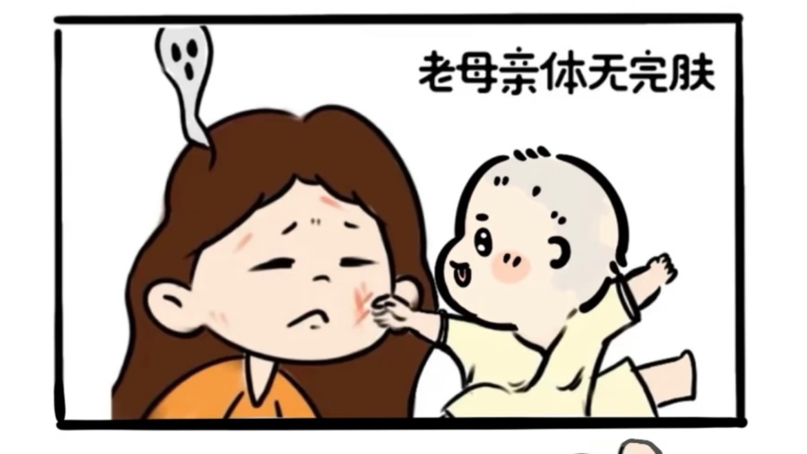 宝宝总抓伤自己