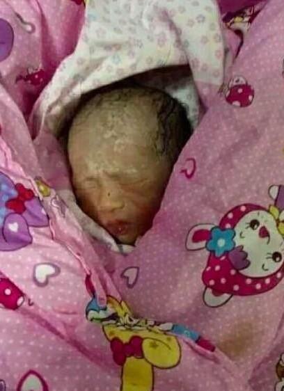 女子看了自己刚生下的小孩大喊: 快拿走, 护士知道原因后大笑不已