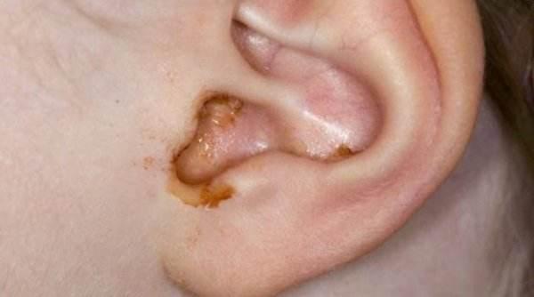 宝宝一直哭闹, 妈妈处理不当差点害了他