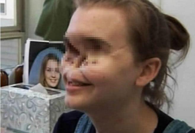 女子玩枪炸烂面部留下大坑, 为了不吓到孩子, 坚持每天戴面具!