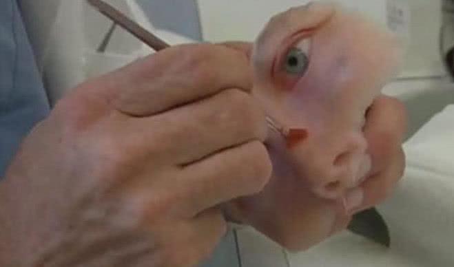 女子玩枪炸烂面部留下大坑, 为了不吓到孩子, 坚持每天戴面具!