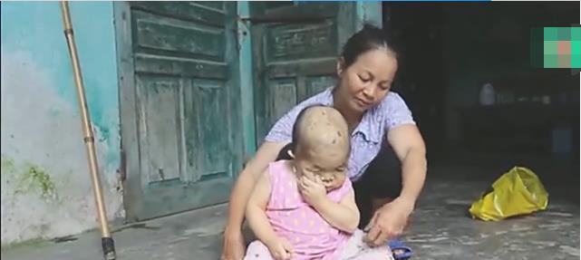 两岁女孩长着“50岁“的面容, 爸妈抛弃只有奶奶真心疼爱她面容