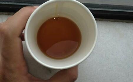 心真大! 男子血尿一年多才去医院, 确诊后吓摊在地