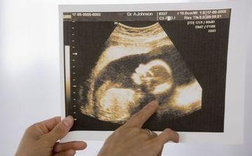 女子四年后终于怀孕, 医生检查, 准妈哭了, 再一问, 老公脸都绿了